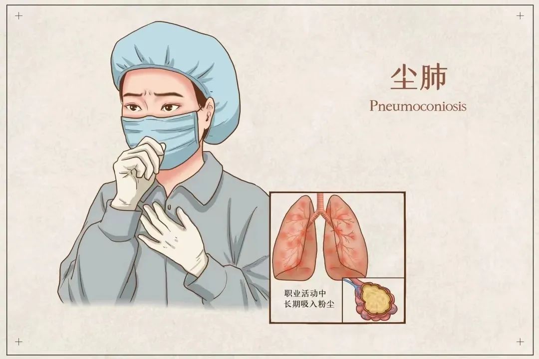 全面解读与关注尘肺病最新政策动态